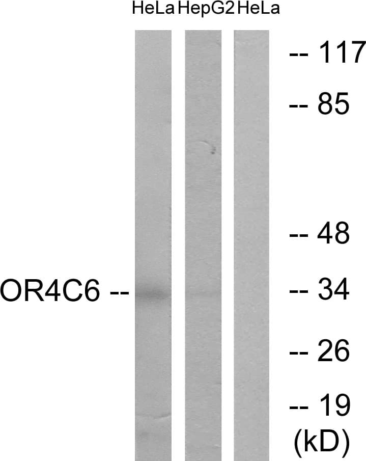 OR4C6 Antibody (aa193-242)