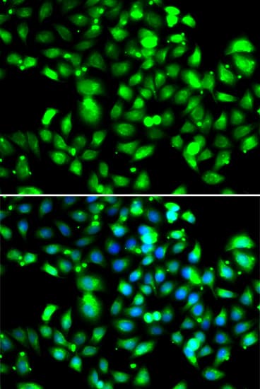 GBP1 Antibody