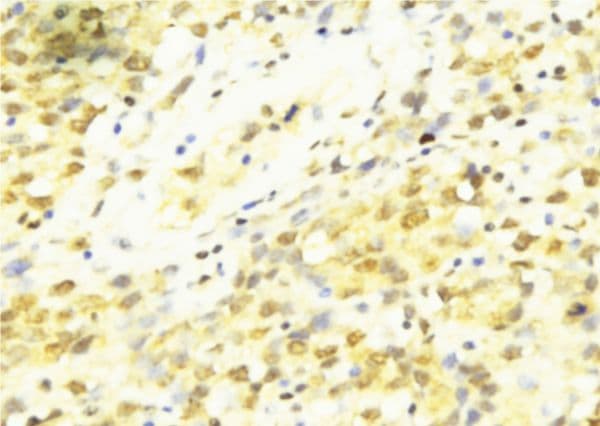 Polyclonal Rabbit anti-Human CCNT1 / Cyclin T1 Antibody (IHC, WB)