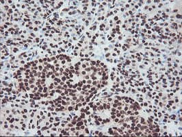 FMR1 / FMRP Antibody (aa36-279, clone OTI5B9)