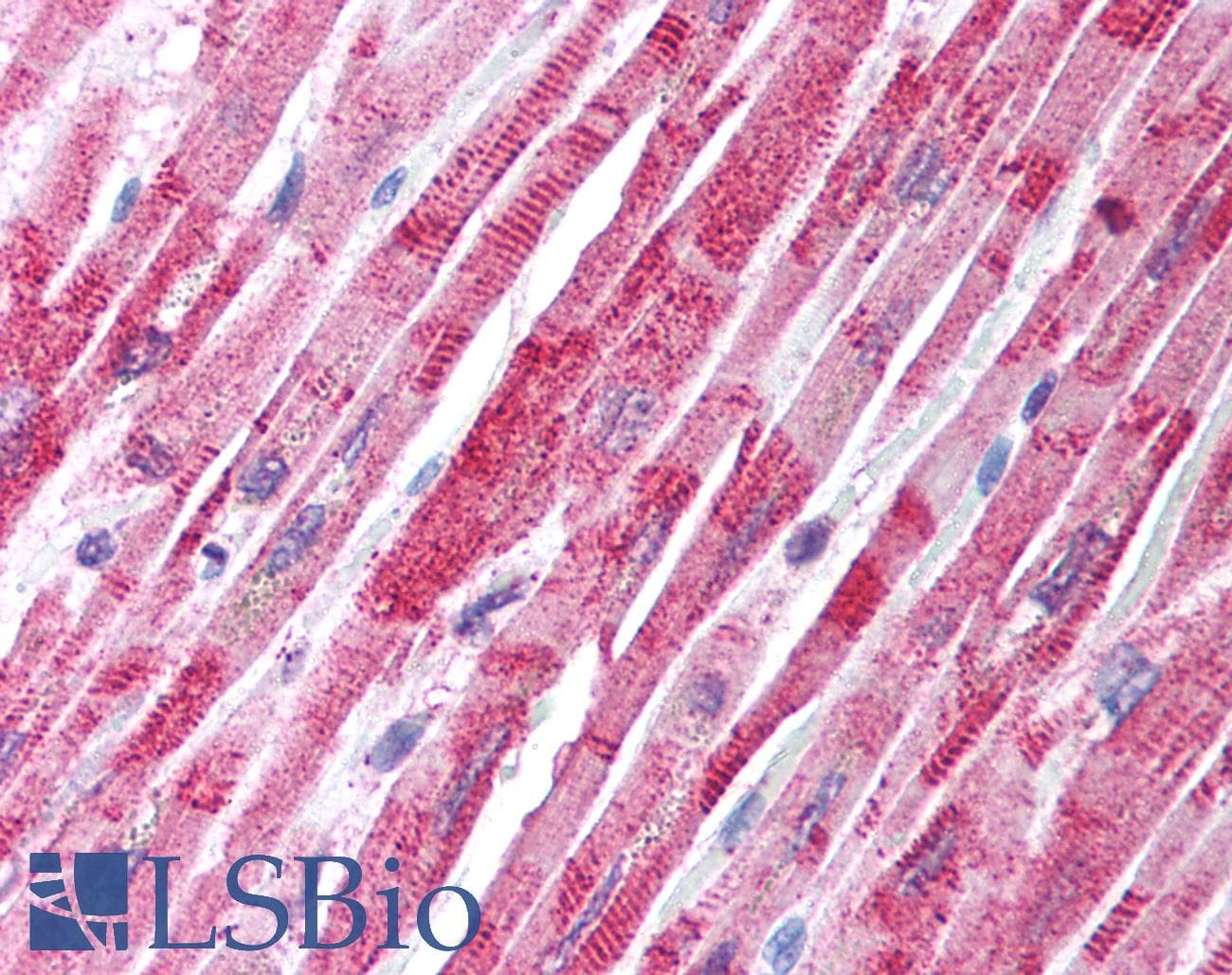 IHC-plus™ Polyclonal Rabbit anti-Human TANK Antibody (IHC, WB)