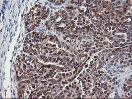 ALS2CR1 / NIF3L1 Antibody (clone OTI1F6)