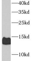 Polyclonal Rabbit anti-Human CALCB Antibody (IHC, WB)
