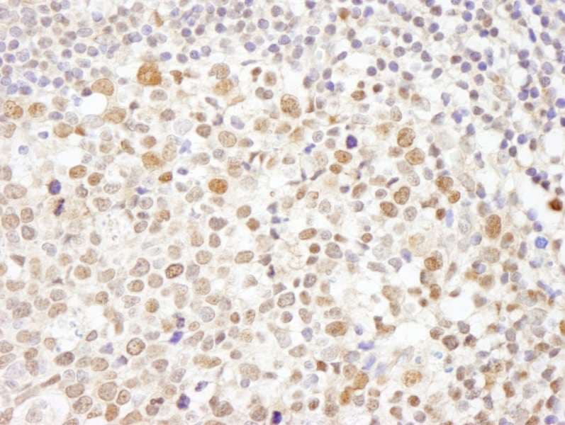 CHAF1A / CAF1 Antibody (aa100-150)