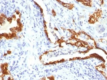 KRT18 / CK18 / Cytokeratin 18 Antibody (clone KRT18/834)