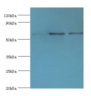 IL22RA1 / IL22R Antibody (aa16-230)