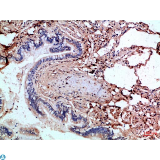 CASP1 / Caspase 1 Antibody