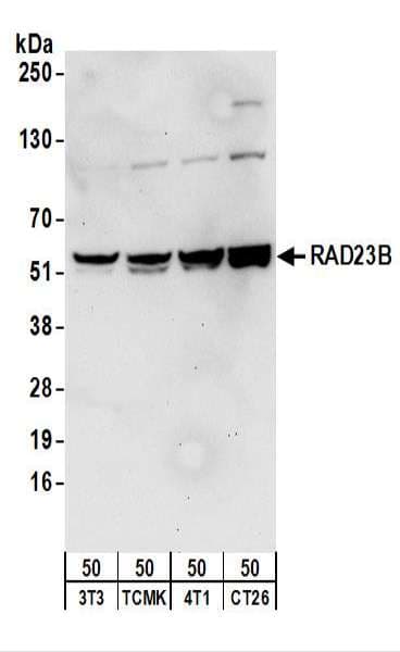Polyclonal Rabbit anti-Human RAD23B / HR23B Antibody (aa359-409, IHC, WB)