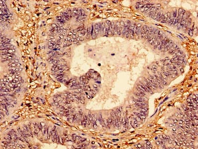 Polyclonal Rabbit anti-Human TP53 / p53 Antibody (aa2-393, IHC, WB)