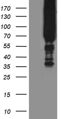 APPL2 Antibody (clone OTI8F1)