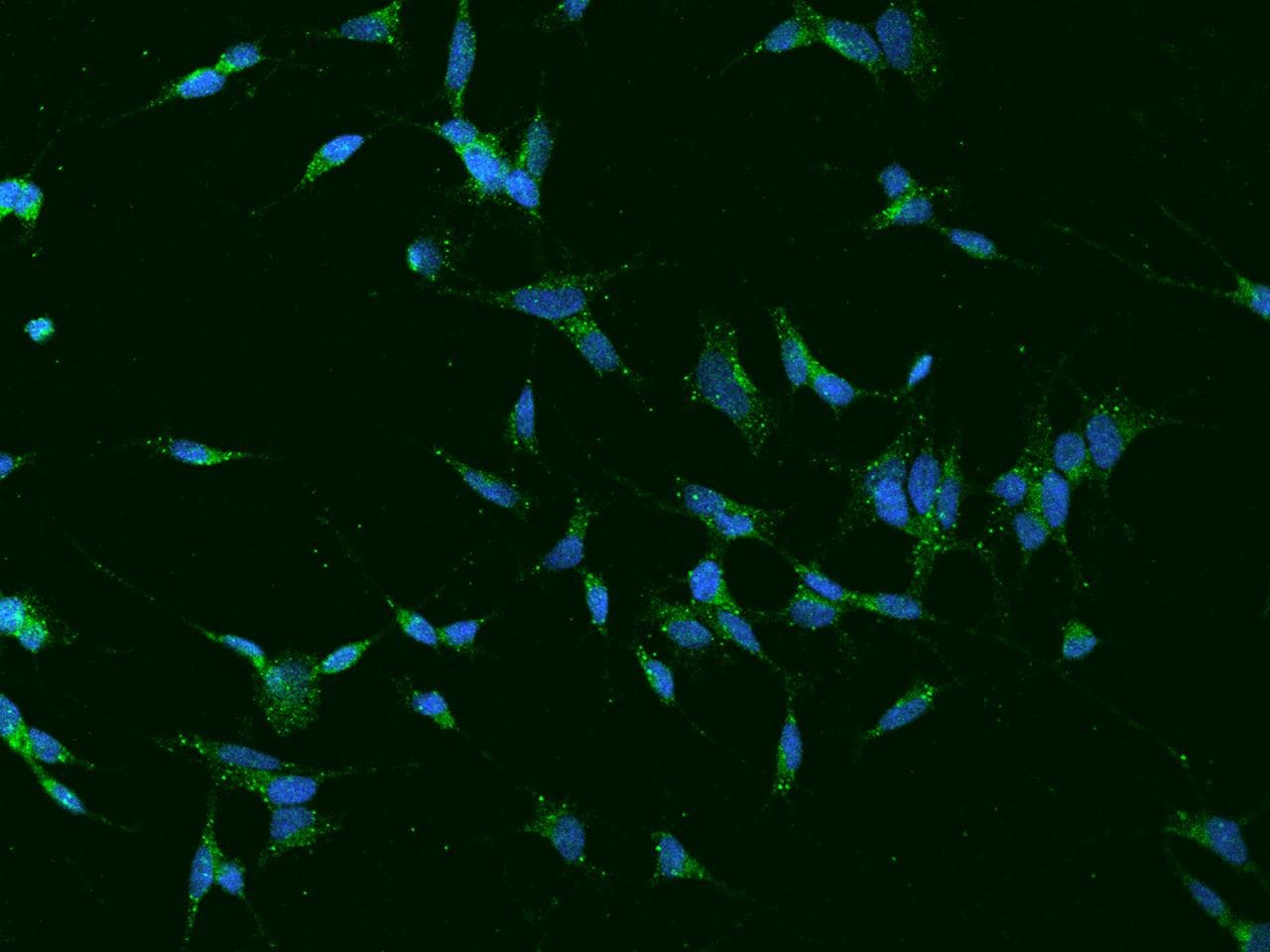 TVP23A / FAM18A Antibody