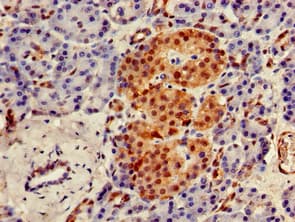UBQLN1 / Ubiquilin Antibody