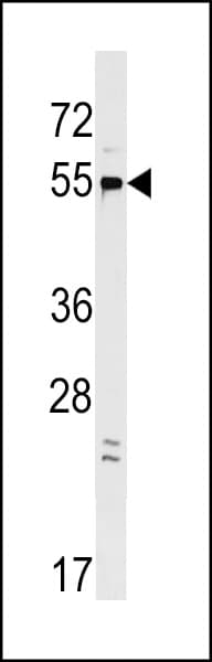 GPR22 Antibody (aa122-148)
