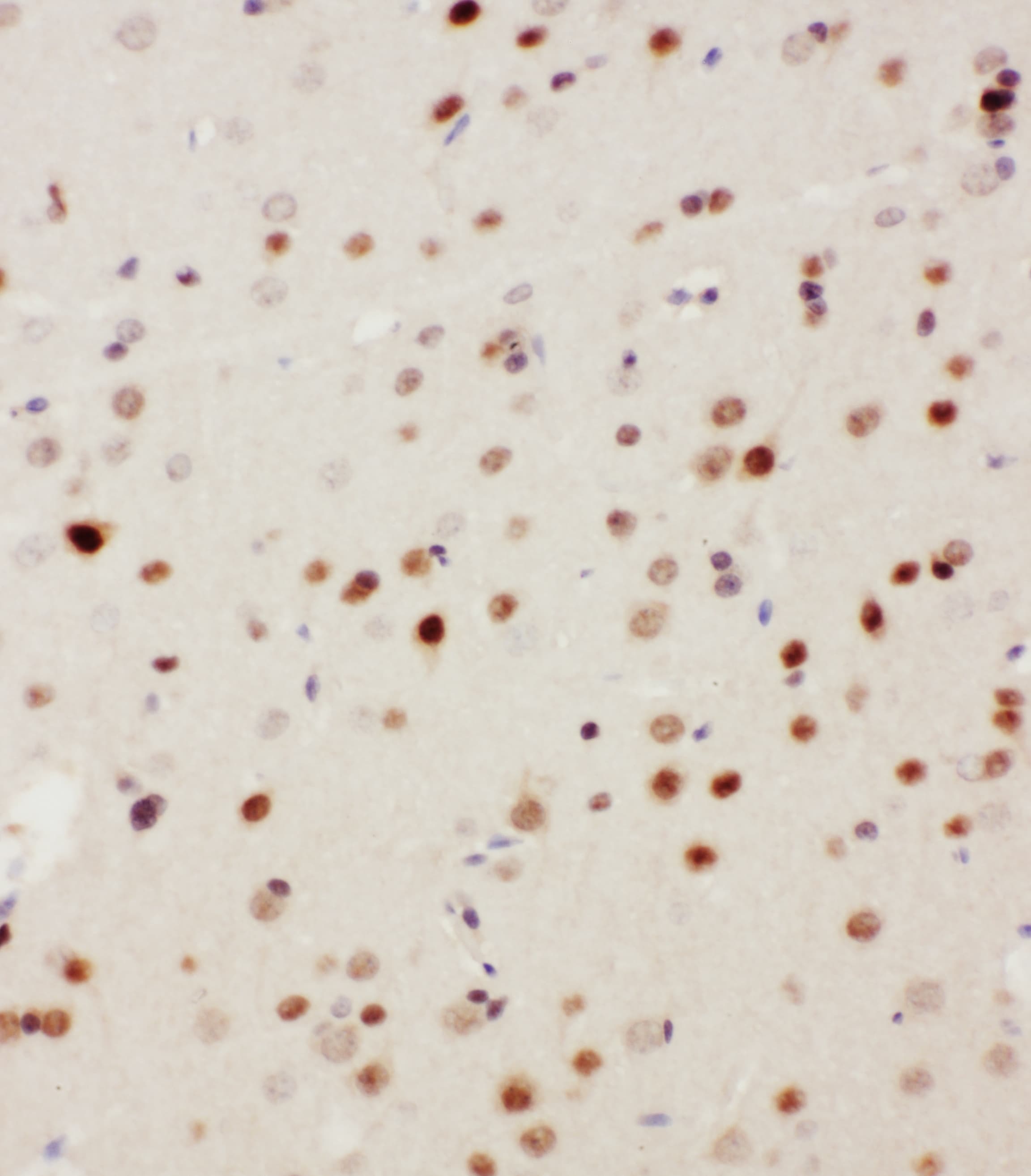 MAP3K3 / MEKK3 Antibody (aa11-25)