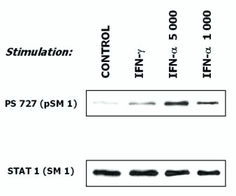 IHC-plus™ STAT1 Antibody (clone SM1)