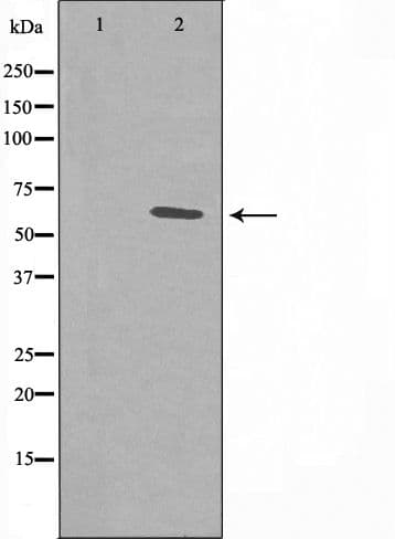 Polyclonal Rabbit anti-Human ER81 / ETV1 Antibody (IF, WB)