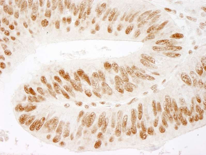 ZNF326 / Zfp326 Antibody (aa532-582)