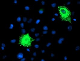 FBXO21 Antibody (clone OTI5H4)