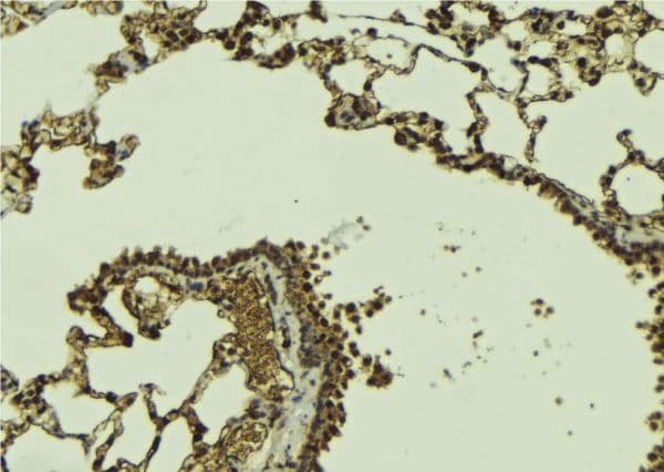 DAXX Antibody