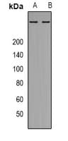 ATM Antibody (Internal)