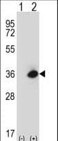 MOK / RAGE Antibody (aa76-104)