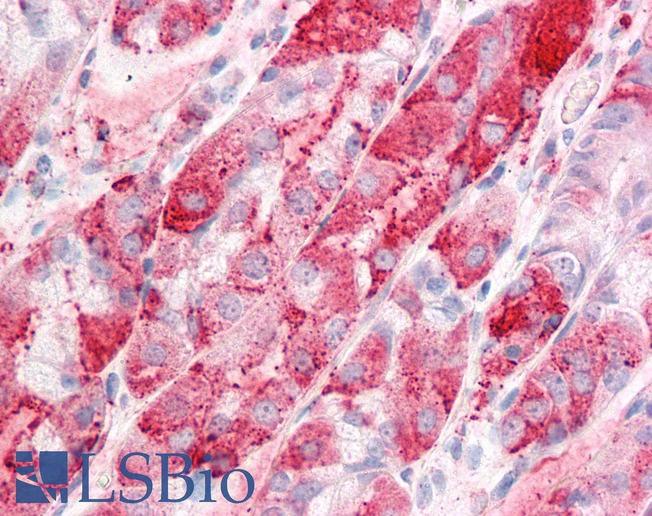 IHC-plus™ Polyclonal Rabbit anti-Human C14orf1 Antibody (Internal, IHC)