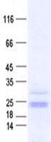 Human ZNF740 Protein (Recombinant His, N-Terminal)