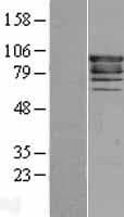 EPS8 Protein (Over-Expression Lysate Myc-DDK (Flag))