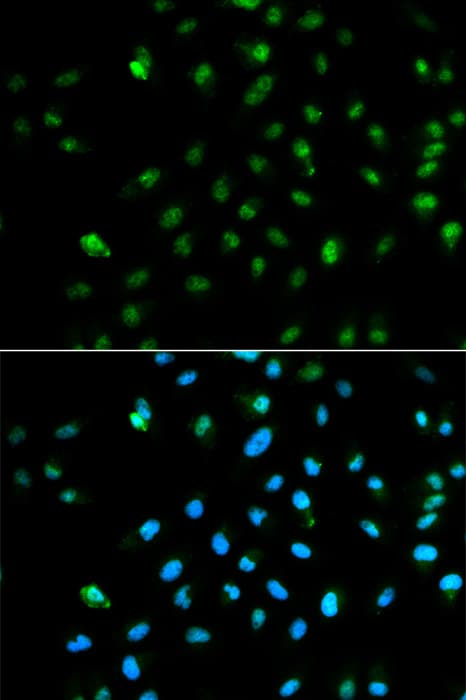 Polyclonal Rabbit anti-Human POLR2A / RNA polymerase II Antibody (IF, WB)
