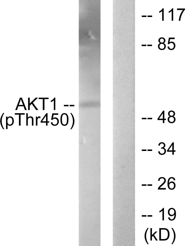 AKT1 Antibody (phospho-Thr450)