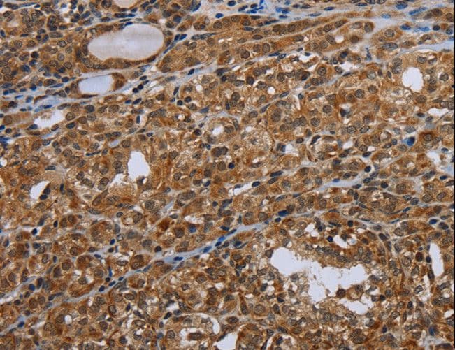 NIRF / UHRF2 Antibody