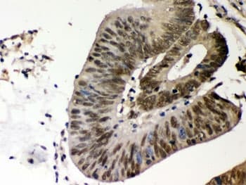 CSNK1A1 / CK1 Alpha Antibody