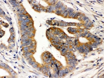 Polyclonal Rabbit anti-Human RAB5A / RAB5 Antibody (IHC, WB)