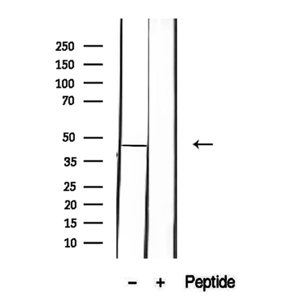 Polyclonal Rabbit anti-Human HOMER1 / Homer 1 Antibody (IHC, IF, WB)