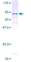 Human RECQ5 / RECQL5 Protein (Recombinant GST)