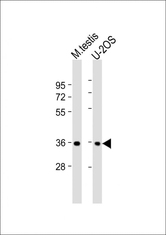 HEXIM2 Antibody (C-Terminus)