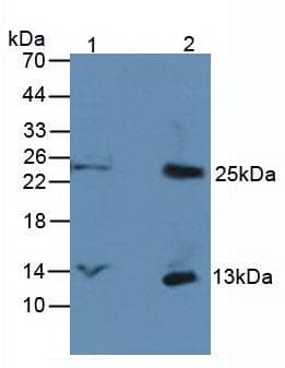 CXCL7 / PPBP Antibody (aa59-128, clone C3)