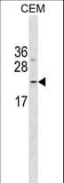 FNDC4 Antibody (aa202-228)