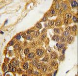 MSX2 / MSH Antibody (aa191-222)