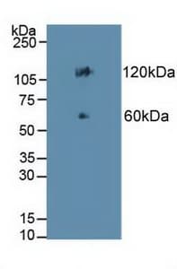 CDH17 / Cadherin 17 Antibody (aa67-351)