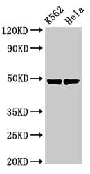 KRT18 / CK18 / Cytokeratin 18 Antibody