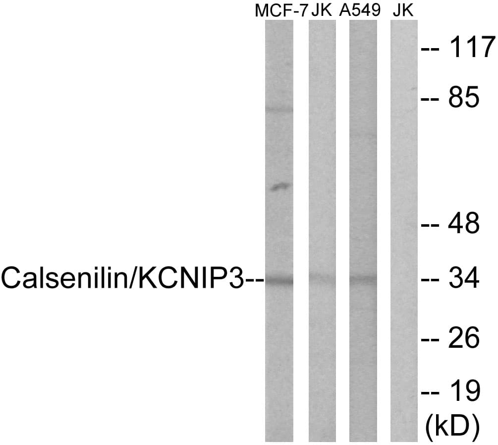 IHC-plus™ Polyclonal Rabbit anti-Human KCNIP3 / Dream / Calsenilin Antibody (aa29-78, IHC, IF, WB)