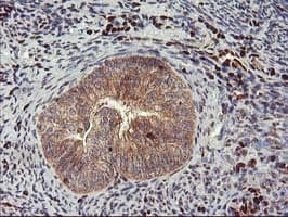 MEF2C Antibody (clone OTI1B6)