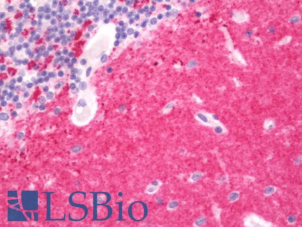 IHC-plus™ SYP / Synaptophysin Antibody (clone 4A2)