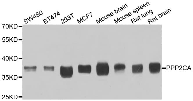 Polyclonal Rabbit anti-Human PP2Ac / PPP2CA Antibody (IHC, IF, WB)