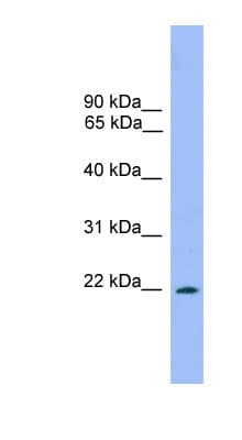 DRGX Antibody (aa151-200)