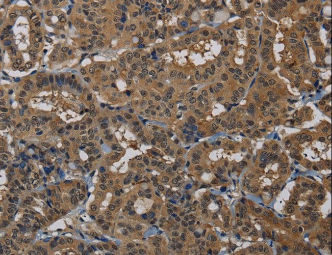 Polyclonal Rabbit anti-Human PNN / Pinin Antibody (IHC)