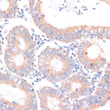 EIF4EBP1 / 4EBP1 Antibody