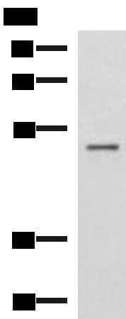 GRWD1 Antibody