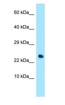 TNFRSF17 / BCMA Antibody (C-Terminus)